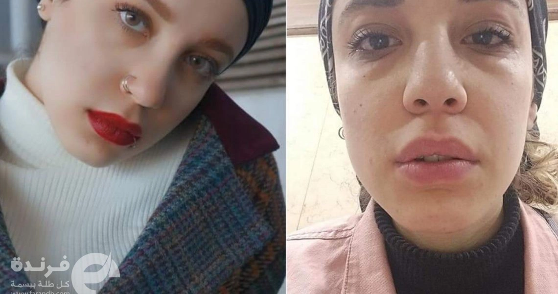 أية عبيد .. بنوتة اسكندرانية ضربت المتحرش فضربها المجتمع | التحرش جريمة